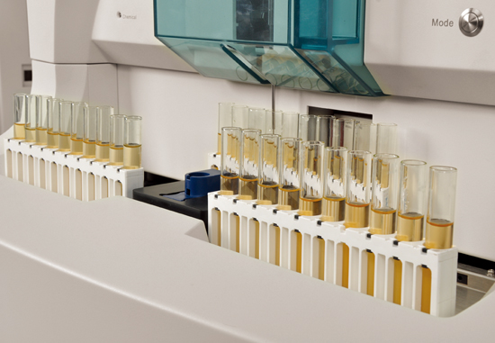 FUS-2000 Urinalysis Hybrid