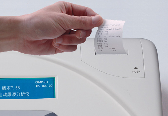 Urine Analyzer Full